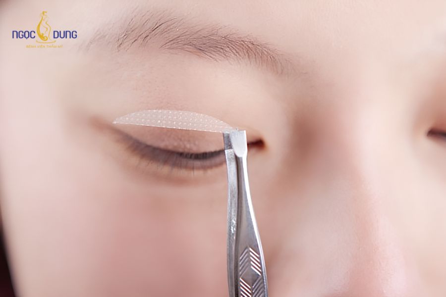 2 mí mắt không đều phải làm sao? Nguyên nhân và cách khắc phục 13 Các mẹo dán kích mí hoặc trang điểm chỉ mang lại hiệu quả khắc phục 2 mí mắt không đều tạm thời