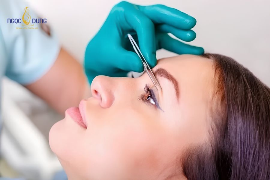 Cắt mí chỉ tác động vào vùng mô mềm bên ngoài, hầu như không xâm lấn cấu trúc nhãn cầu