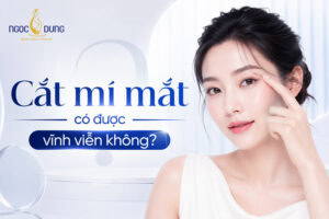 Cắt mí mắt có được vĩnh viễn không