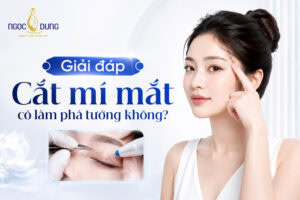 Cắt mí mắt có phá tướng không
