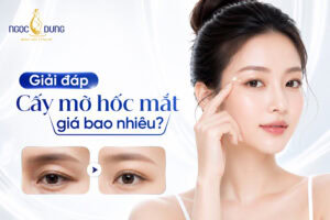 Cấy mỡ hốc mắt giá bao nhiêu