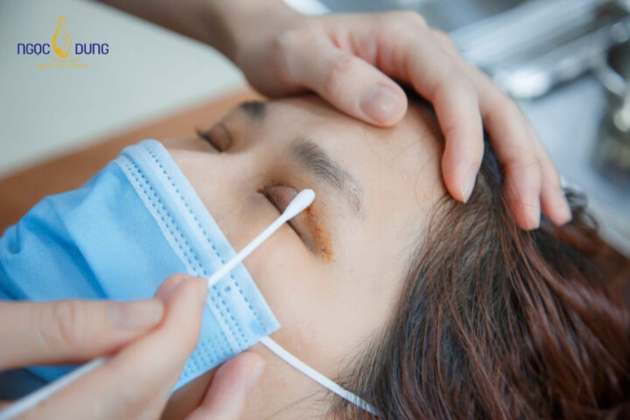 Cắt mí có ảnh hưởng tới thị lực không? Mờ mắt sau khi cắt mí 13 Chăm sóc hậu phẫu đúng cách giúp đôi mắt nhanh phục hồi và giảm nhanh triệu chứng mờ nhòe