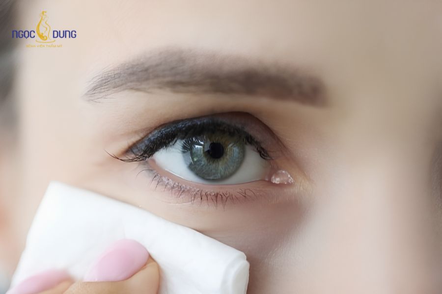 Cắt chỉ mí mắt bị sót có sao không? Cần đi bệnh viện không? 13 Khách hàng nên giữ vệ sinh mắt bằng nước muối sinh lý và liên hệ với cơ sở y tế để được hỗ trợ