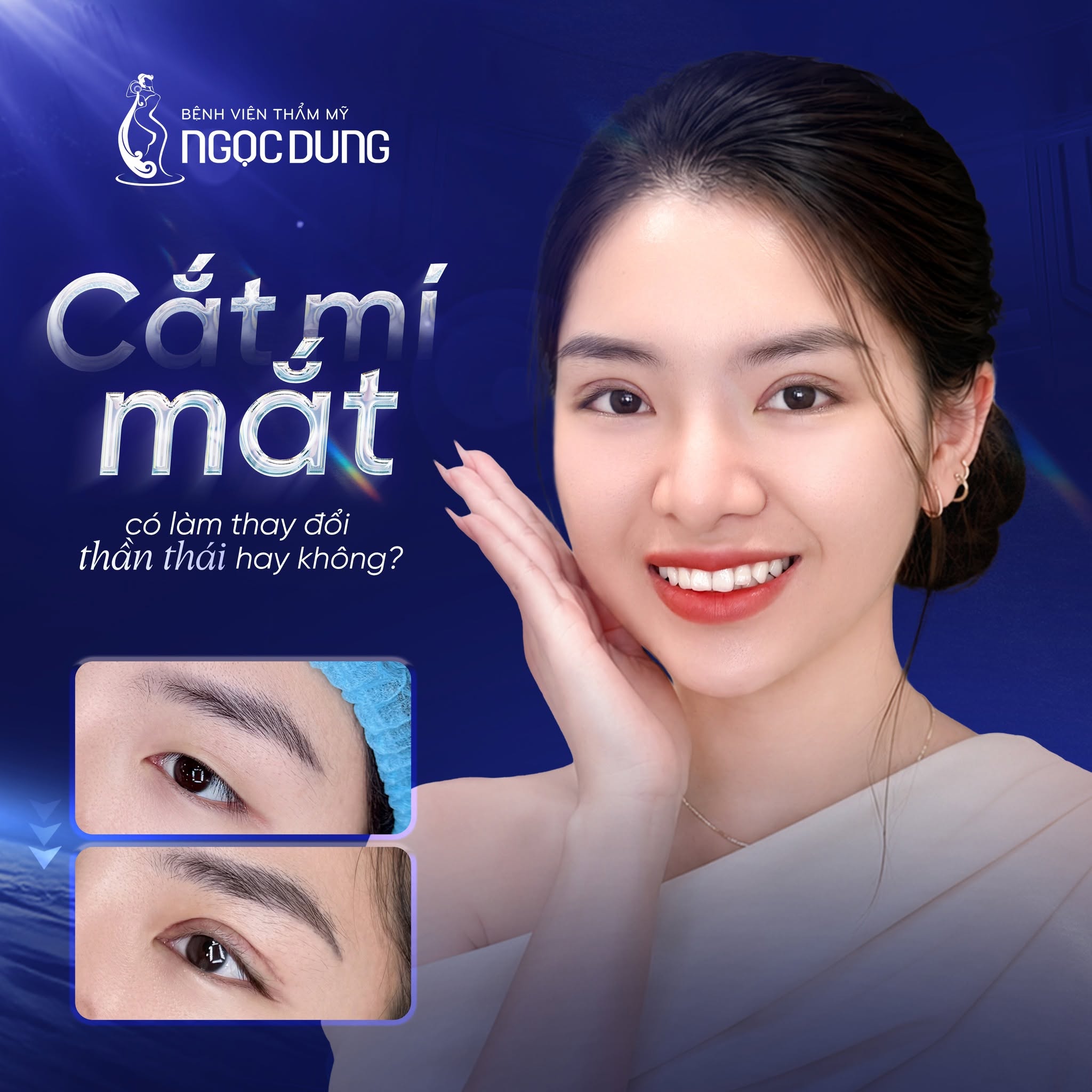 Cắt mí mắt có phá tướng không? Có thay đổi vận mệnh không? 7 Sự tự tin sau khi hoàn thiện diện mạo chính là chìa khóa mở ra nhiều cơ hội mới