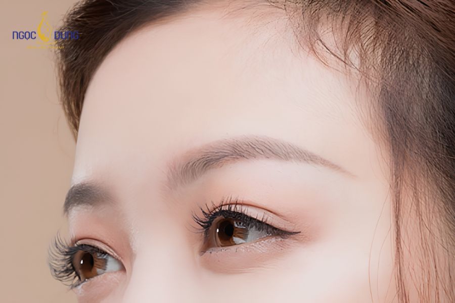 Cắt mí kiêng ăn trứng bao lâu? Có ăn trứng được không? 9 Thời gian kiêng cữ lý tưởng khuyến cáo từ chuyên gia để cấu trúc mô dưới da ổn định