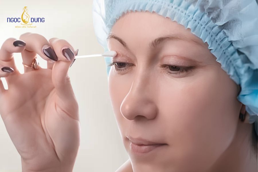 Cắt mí mắt có ăn được thịt dê không? Nên kiêng bao lâu? 12 Vệ sinh vết mổ nhẹ nhàng bằng nước muối sinh lý giúp giữ vùng mi luôn sạch thoáng