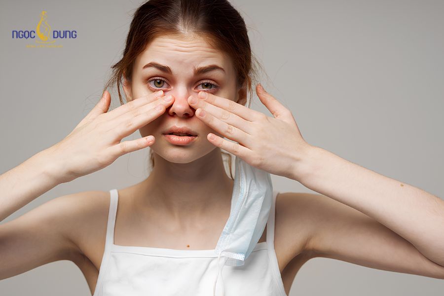 Cắt mí mắt bị trợn: Nguyên nhân và cách khắc phục hiệu quả 8 Việc mắt khó nhắm khít khiến tuyến lệ tiết ra liên tục, mắt đau rát