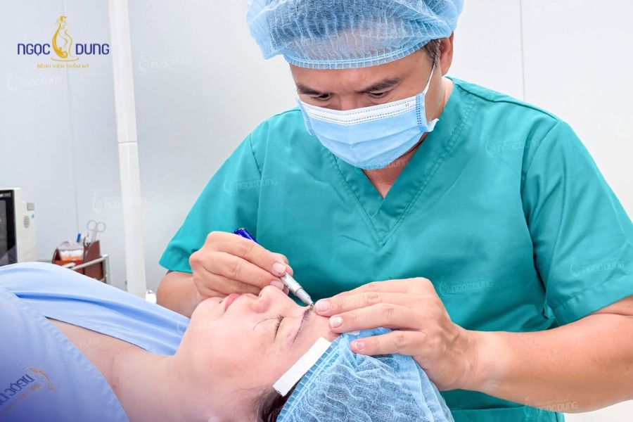 Căng da vùng thái dương: Phương pháp, bảng giá và quy trình 15 Bác sĩ đo vẽ tỷ lệ và đánh giá mức độ da chùng chảy xệ