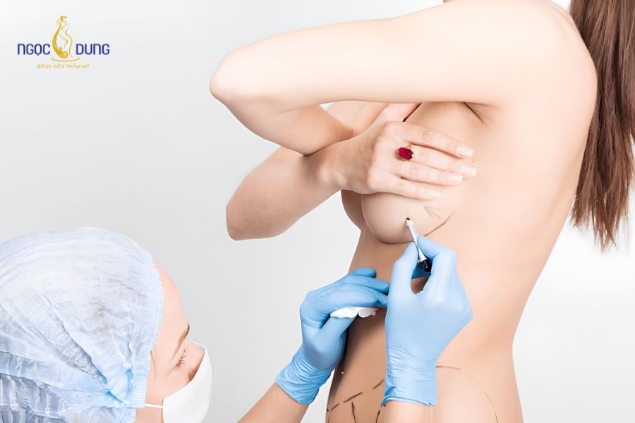Tổng hợp các loại túi nâng ngực phổ biến và cách chọn 14 Bác sĩ dùng thước đo đo đạc các chỉ số lồng ngực của khách hàng