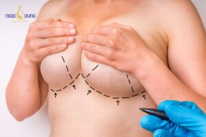 Bầu ngực căng mềm tự nhiên, hài hòa tuyệt đối với các đường nét cơ thể