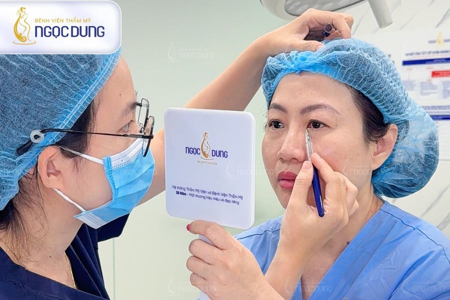 Cắt mí bao nhiêu tiền? Tổng hợp bảng giá dịch vụ cắt mí mắt 14 Bệnh viện Thẩm mỹ Ngọc Dung là địa chỉ mang lại sự an tâm cao cho khách hàng muốn sở hữu mắt 2 mí