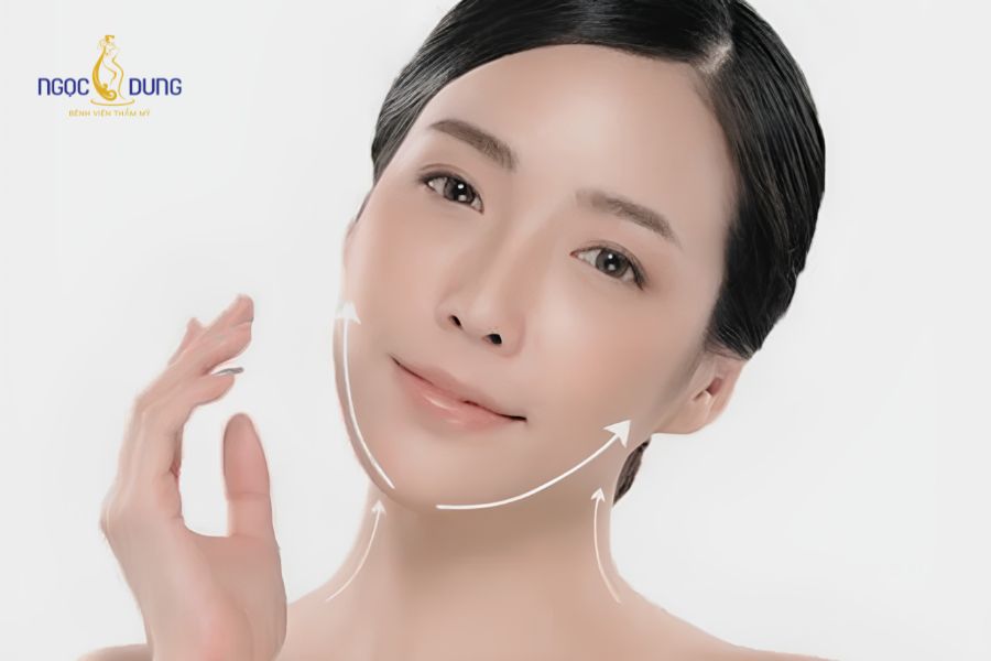 Hút mỡ má: Lợi ích, phương pháp và quy trình chuẩn 2026 13 Các giai đoạn hồi phục và gom form của gương mặt