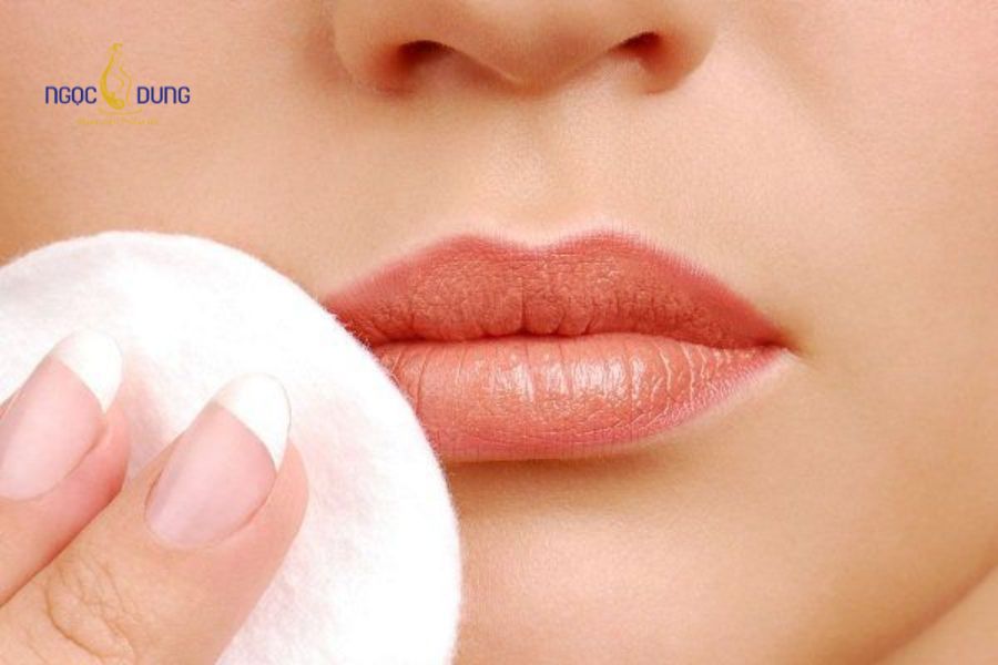 Dịch vụ phẫu thuật tạo hình môi đẹp chuẩn hóa ở Ngọc Dung 11 Cần lưu ý chăm sóc đúng cách sau khi phẫu thuật tạo hình môi để kết quả tối ưu