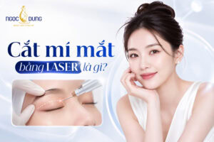 Cắt mí mắt bằng Laser