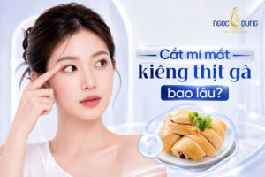cắt mí kiêng thịt gà bao lâu