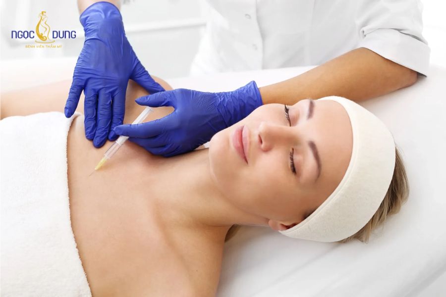 Nâng ngực bằng filler: Giá bao nhiêu, có an toàn không? 10 Chất làm đầy (filler) được đưa vào mô mềm nhằm tăng thể tích vòng 1 tạm thời