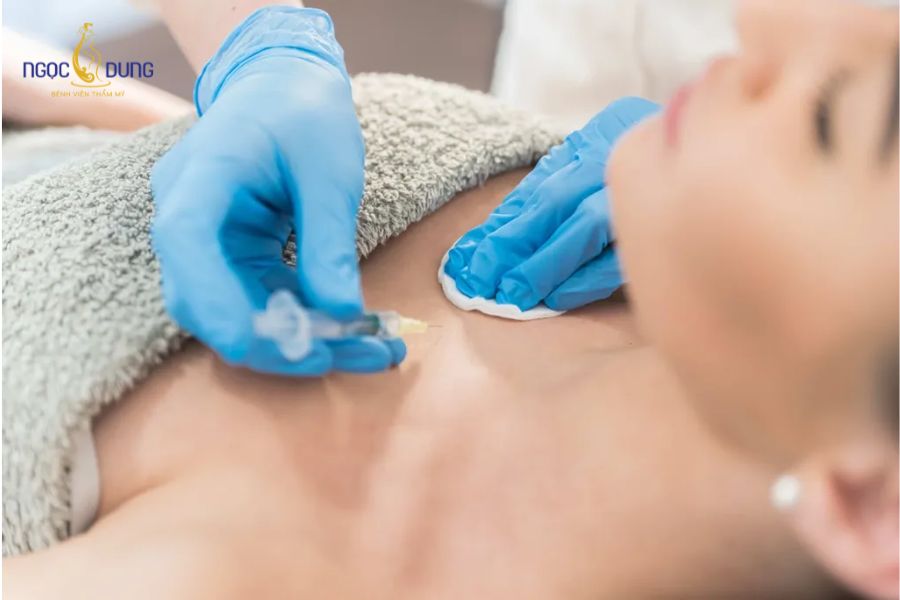 Nâng ngực bằng filler: Giá bao nhiêu, có an toàn không? 12 Chất làm đầy tồn dư cản trở việc siêu âm và chụp nhũ ảnh định kỳ