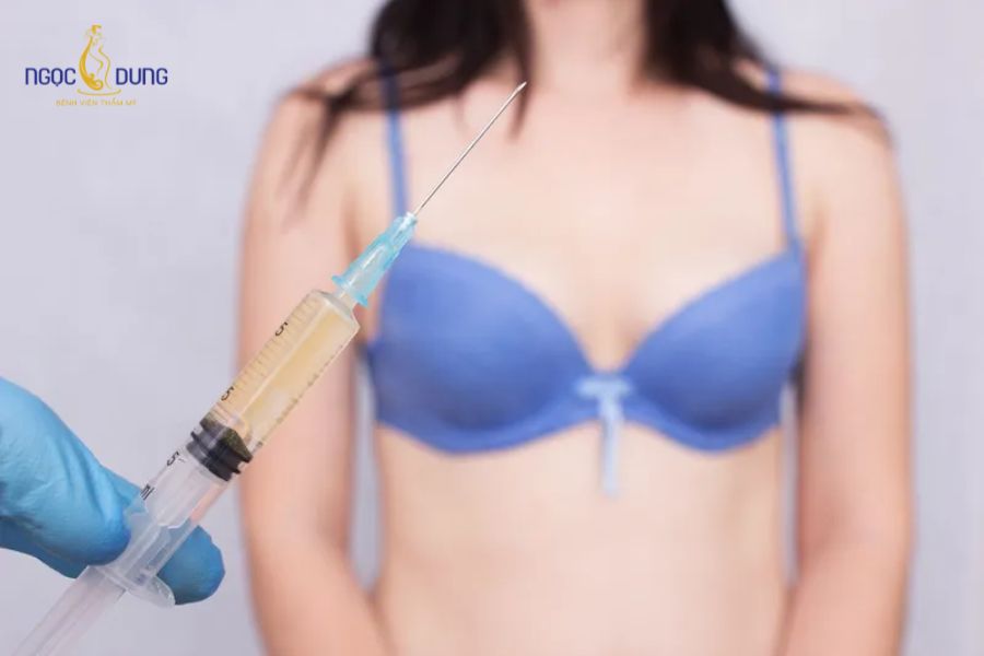 Nâng ngực bằng filler: Giá bao nhiêu, có an toàn không? 14 Chi phí tiêm filler ngực phụ thuộc vào dung tích thể tích và thương hiệu chất làm đầy
