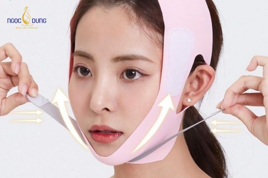 Hút mỡ nọng cằm: Thon gọn mặt chuẩn y khoa, Ngọc Dung 20 Đeo băng ép hoặc đai định hình cằm liên tục theo chỉ định, thường trong 1-2 tuần đầu để giữ form dáng