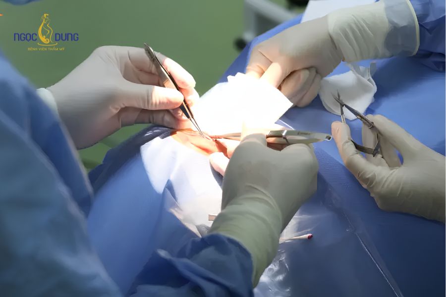 Cắt u mỡ vàng quanh mắt an toàn, không để lại sẹo 9 Dịch vụ cắt u mỡ vàng chuẩn y khoa tại Bệnh Viện Thẩm Mỹ Ngọc Dung