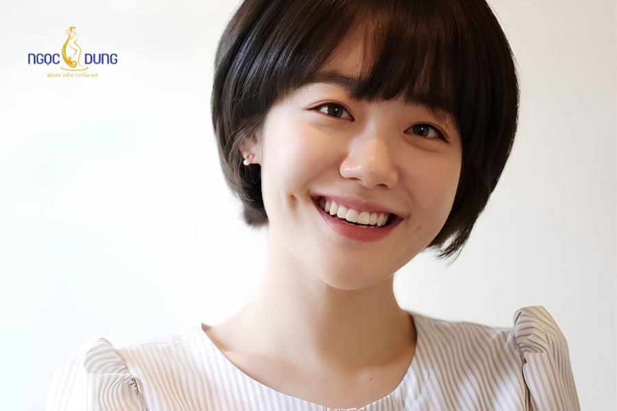 Cắt đồng điếu là gì? Chi phí, quy trình và ý nghĩa nhân tướng học 7 Điểm lõm đồng điếu duyên dáng sát khóe miệng mỗi khi cười