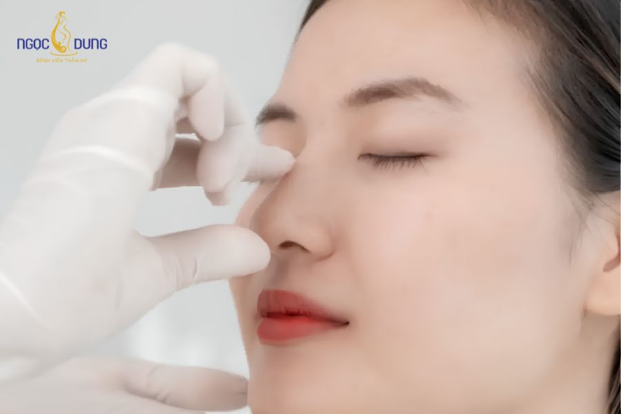 Nâng mũi sụn surgiform: Ưu nhược, quy trình và bảng giá 9 Đối tượng phù hợp để nâng mũi bằng sụn Surgiform