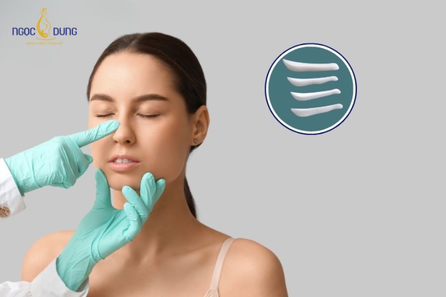 Nâng mũi sụn surgiform: Ưu nhược, quy trình và bảng giá 8 Đối tượng phù hợp để nâng mũi bằng sụn Surgiform
