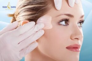 Độn vùng thái dương đầy đặn giúp gương mặt hài hòa, cân đối
