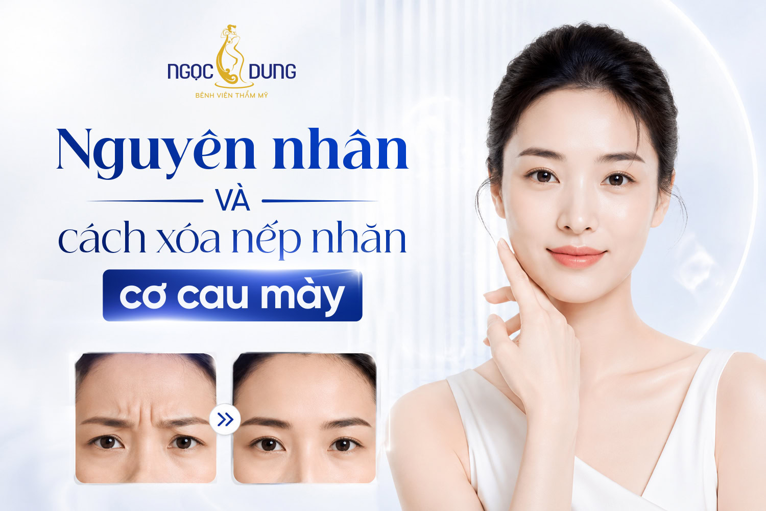 Giảm nhăn cơ cau mày