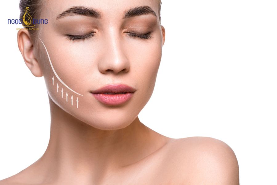 Hút mỡ má: Lợi ích, phương pháp và quy trình chuẩn 2026 11 Gương mặt thanh thoát, cân đối sau khi loại bỏ mỡ má