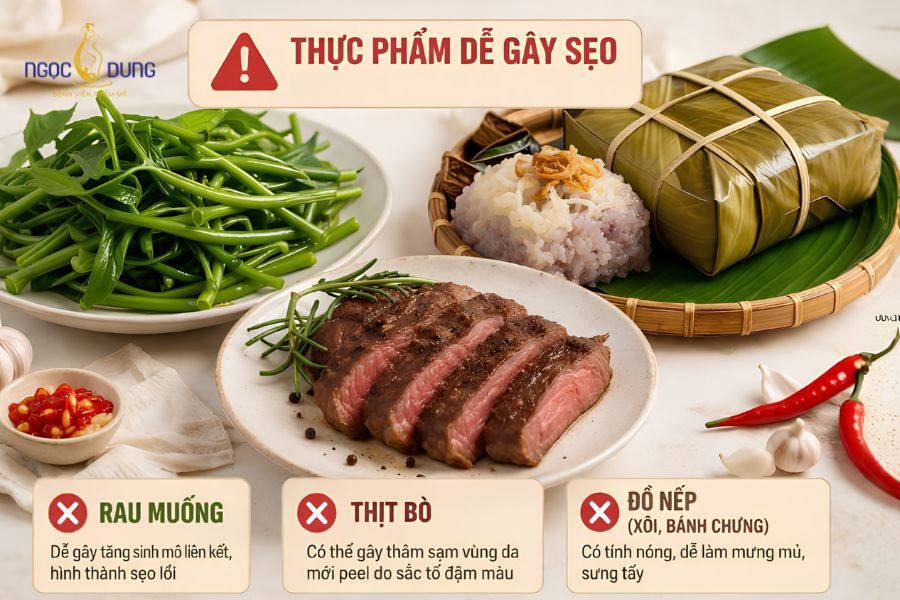 Hút mỡ bắp chân: Giải pháp gọn an toàn tại Ngọc Dung 18 Hạn chế thực phẩm dễ gây sẹo lồi hoặc viêm sau khi thực hiện