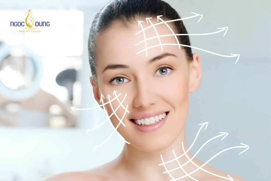 Căng da mặt mini: Ưu nhược điểm, bảng giá và quy trình 8 Kết quả trẻ hóa vùng viền hàm tự nhiên sau căng da mặt mini