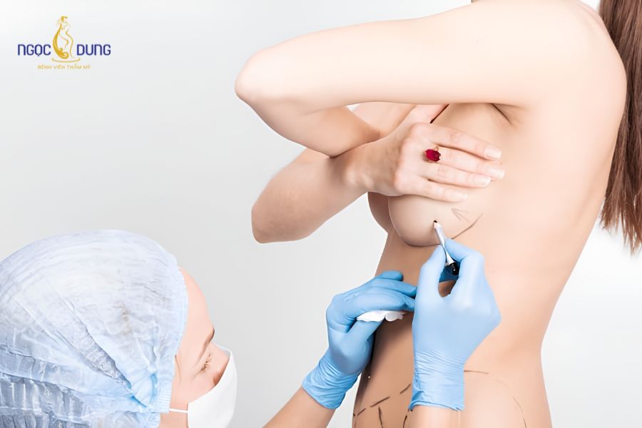 Phẫu thuật thu nhỏ ngực: Bảng giá, quy trình và lưu ý 17 Khách hàng giữ cân nặng ổn định để duy trì kết quả dáng ngực