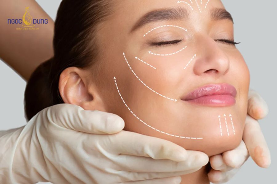 Căng da mặt mini: Ưu nhược điểm, bảng giá và quy trình 9 Khách hàng ở độ tuổi lão hóa nhẹ đến trung bình phù hợp căng da mini