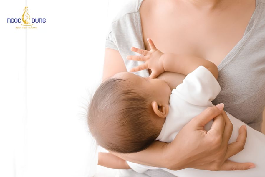 Nâng ngực sa trễ: Phân loại, phương pháp và bảng giá 17 Khách hàng sau sinh nở bị teo lép mô tuyến vú nhận tư vấn phác đồ từ chuyên gia