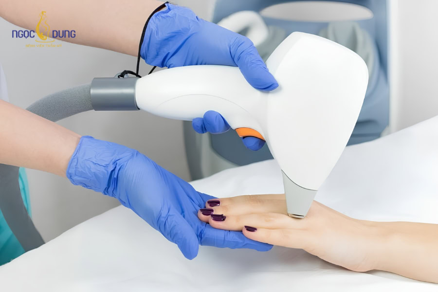 Cấy mỡ bàn tay: Trẻ hóa đôi tay tự nhiên an toàn uy tín 15 Khách hàng tái khám để bác sĩ đánh giá độ phẳng mịn của mu bàn tay