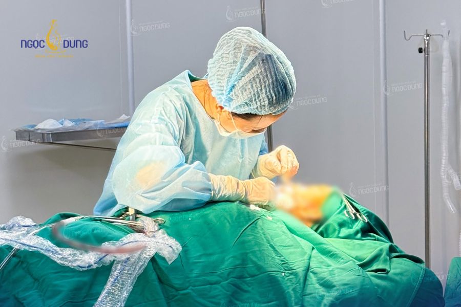 Hút mỡ má: Lợi ích, phương pháp và quy trình chuẩn 2026 12 Khách hàng thoải mái trong suốt ca tiểu phẫu nhờ phương pháp gây mê