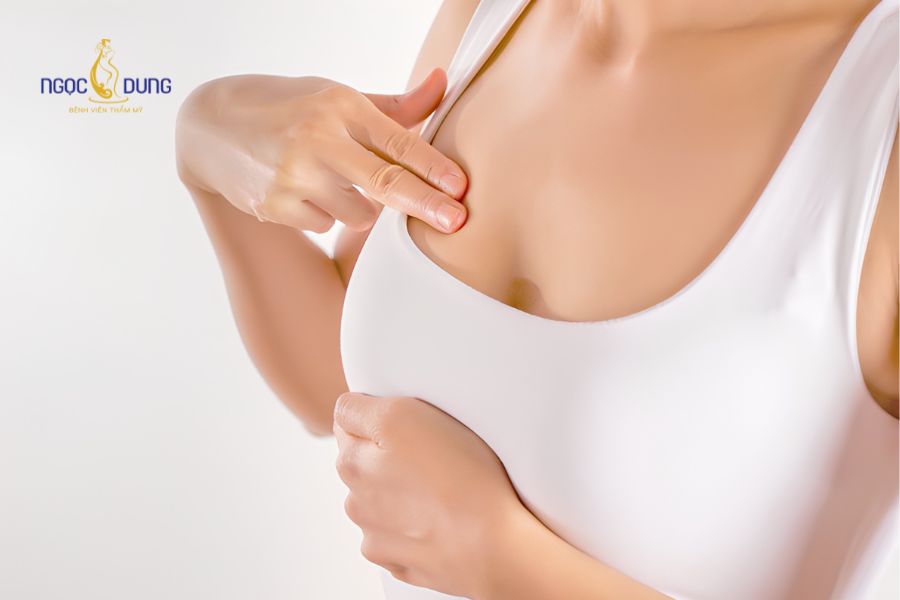 Có nên nâng ngực không? Lời khuyên từ chuyên gia Ngọc Dung 15 Kỹ thuật cuộn mô và loại bỏ da thừa khắc phục tình trạng ngực chảy xệ