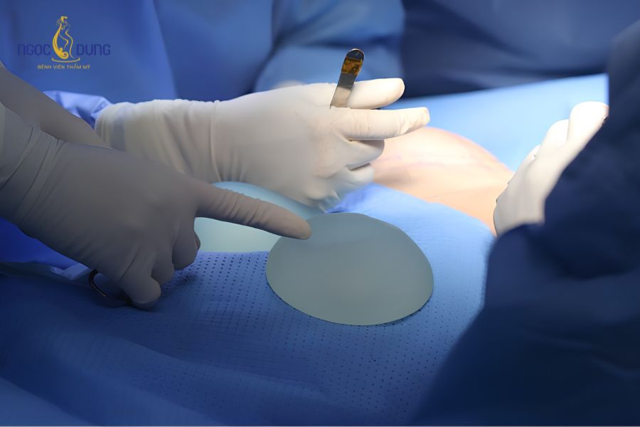 Các phương pháp nâng ngực an toàn, phổ biến nhất hiện nay 9 Kỹ thuật đặt túi độn tạo phom dáng đầy đặn cho vùng ngực