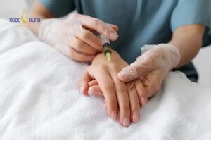 Kỹ thuật tiêm cấy mô mỡ tự thân làm đầy các vùng lõm hóp ở mu bàn tay