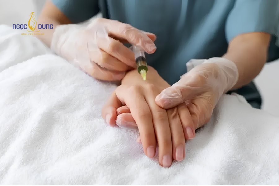 Cấy mỡ bàn tay: Trẻ hóa đôi tay tự nhiên an toàn uy tín 10 Kỹ thuật tiêm cấy mô mỡ tự thân làm đầy các vùng lõm hóp ở mu bàn tay