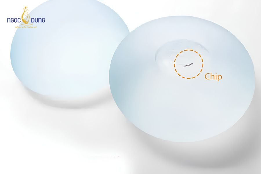 Nâng ngực nội soi túi Ergonomic chuẩn y khoa, Ngọc Dung 9 Một số dòng túi Ergonomic được nhà sản xuất tích hợp chip điện tử siêu nhỏ