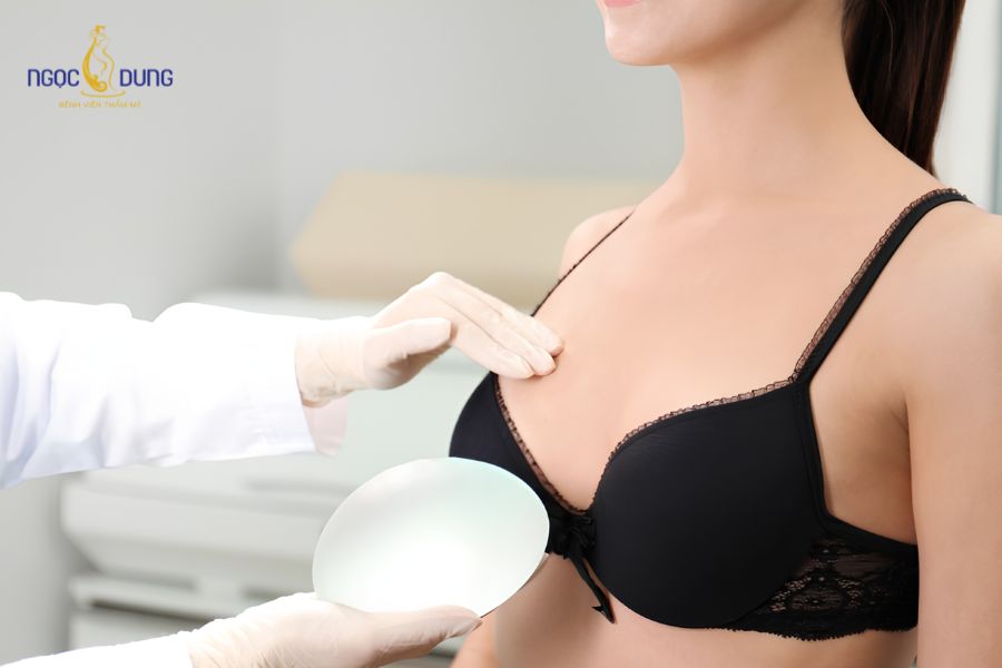 Nâng ngực nội soi túi Nano: Bảng giá, quy trình chuẩn 12 Nâng ngực nội soi túi Nano là phương pháp đưa túi độn silicone vào bằng cách nội soi