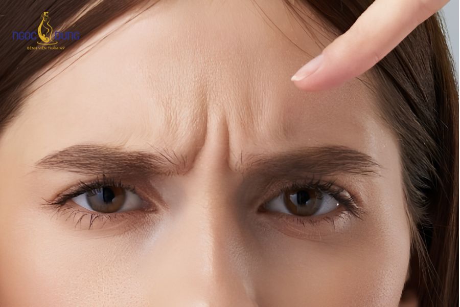 10 cách giảm nhăn cơ cau mày an toàn, lấy lại thanh xuân 12 Nguyên nhân chính gây hằn nếp nhăn giữa hai chân mày