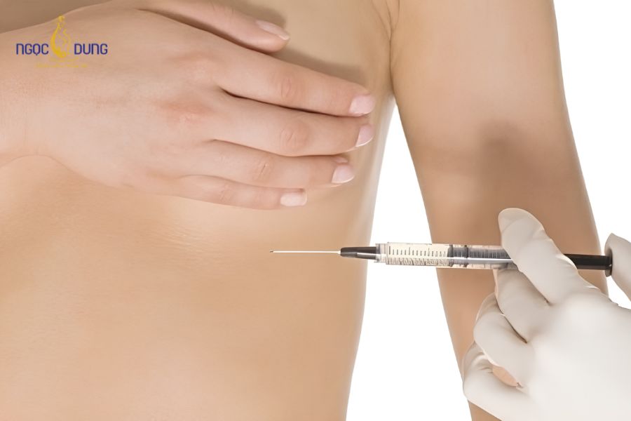 Nâng ngực bằng filler: Giá bao nhiêu, có an toàn không? 13 Những nhược điểm chi phí đắt đỏ và tiềm ẩn nhiều rủi ro sức khỏe khi tiêm filler ngực