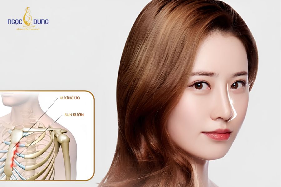 Nâng mũi sụn sườn: Ưu nhược điểm, bảng giá và quy trình 8 Những trường hợp nên thực hiện nâng mũi bằng sụn sườn