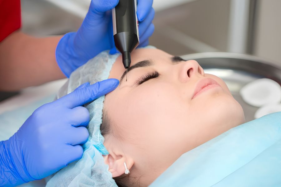 Phẫu thuật cắt mí laser: Thông tin cần biết từ A - Z 10 Phương pháp cắt mí bằng laser phù hợp cho tình trạng mắt có nhiều da chùng, mỡ thừa