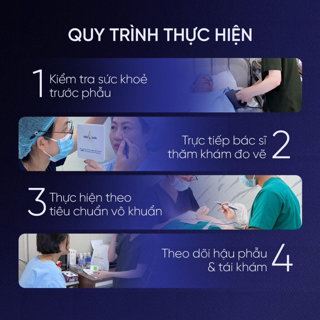 Căng da vùng thái dương: Phương pháp, bảng giá và quy trình 17 Quy trình trẻ hóa vùng thái dương khép kín theo chuẩn Bộ Y tế