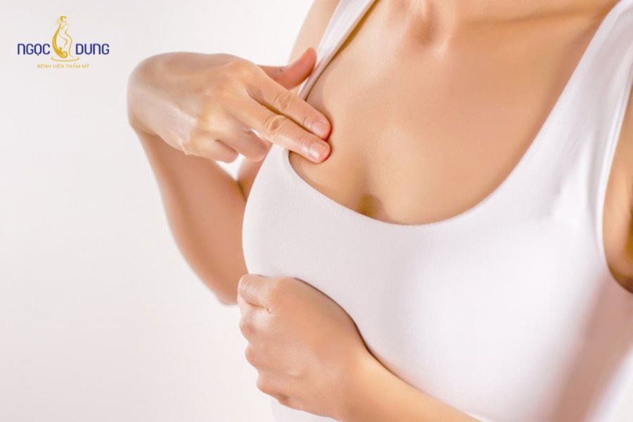 Nâng ngực bao lâu thì mềm? Chăm sóc vòng 1 tự nhiên 13 Sự hình thành lớp bao xơ sinh lý quanh túi độn khiến vòng 1 căng cứng tạm thời sau mổ