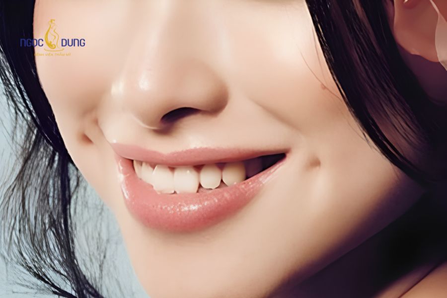 Cắt đồng điếu là gì? Chi phí, quy trình và ý nghĩa nhân tướng học 12 Thăm khám cấu trúc cơ mặt cẩn thận trước khi tiến hành tiểu phẫu
